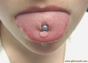 O piercing na boca inflamou: o que fazer?