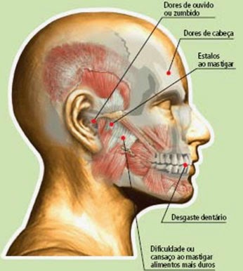 Doctus Premier Odontologia - O que é DTM? A articulação temporomandibular  (ATM) age como uma dobradiça, conectando o maxilar ao crânio. Esta  disfunção pode causar dor e desconforto. Dores na mandíbula, dificuldade